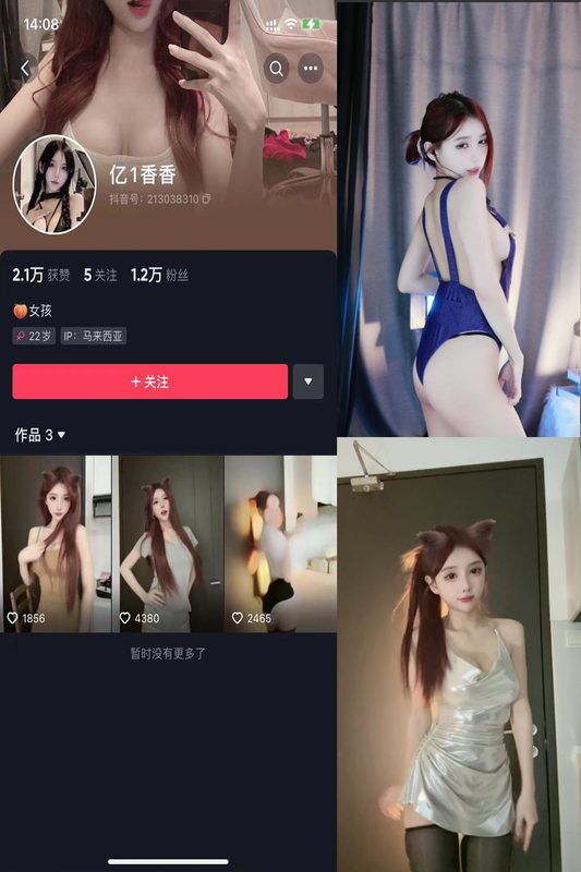 抖音 亿1香香 微密圈 NO.003期 【24V】-MIYI