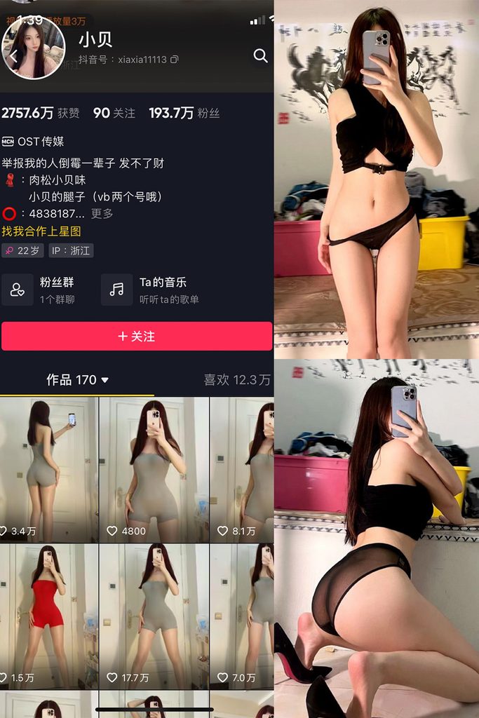 图片[1]-抖音 小贝 VIP 微密圈 NO.003期 【32P】-MIYI