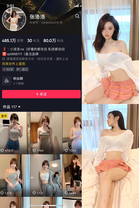 抖音 张洛洛 微密圈 NO.001期 【30P】-MIYI