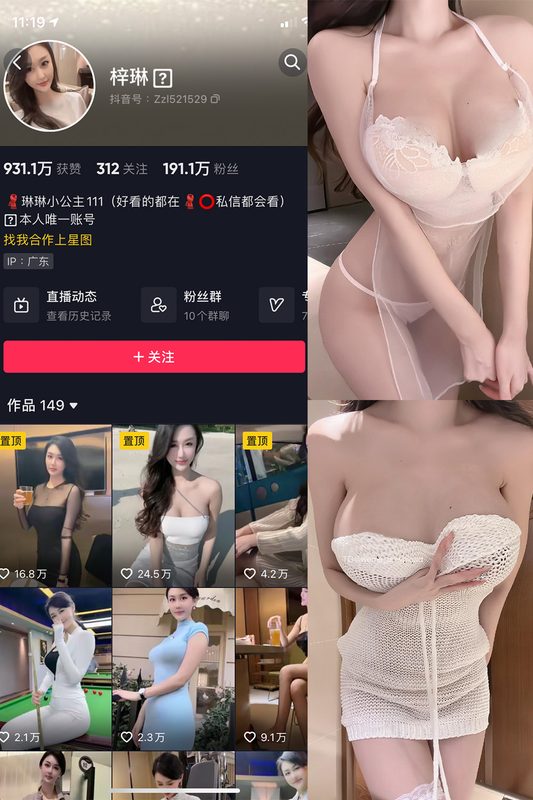 抖音 琳琳小公主 微密圈 002 期 【31P1V】-MIYI